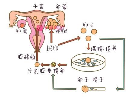 子宫