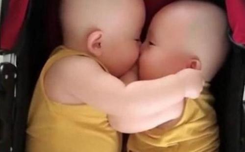 四川锦欣西囡妇女儿童医院(毕昇院区)告诉您：想要双胞胎宝宝不是靠运气而是看这些！！！