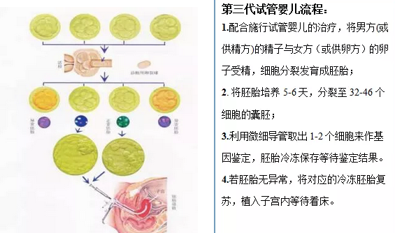 第三代试管婴儿