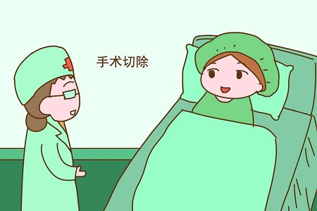 巧克力囊肿要不要做手术