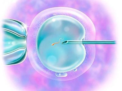 卵细胞浆内单精子显微注射（ICSI）示意图