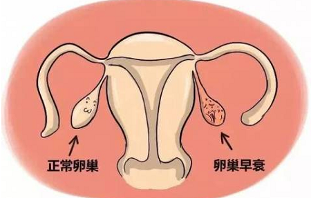 女人要保护卵巢，守住年轻，远离早衰问题!