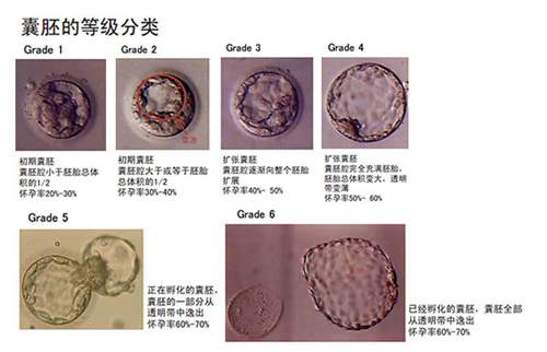 囊胚移植对于试管婴儿的优势以及成功率有什么影响