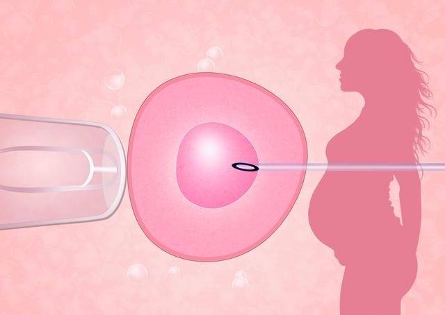 在试管婴儿的过程中需要取多少卵子才能容易受孕