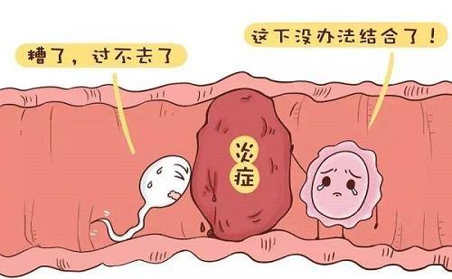 输卵管存在以下问题可能导致不孕