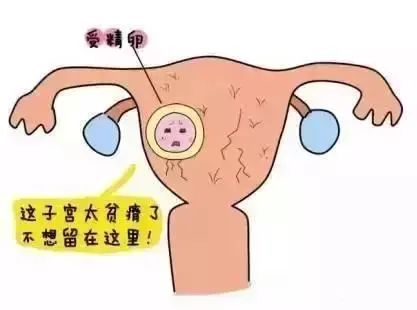 受精卵:这子宫太贫瘠了,不想留在这里
